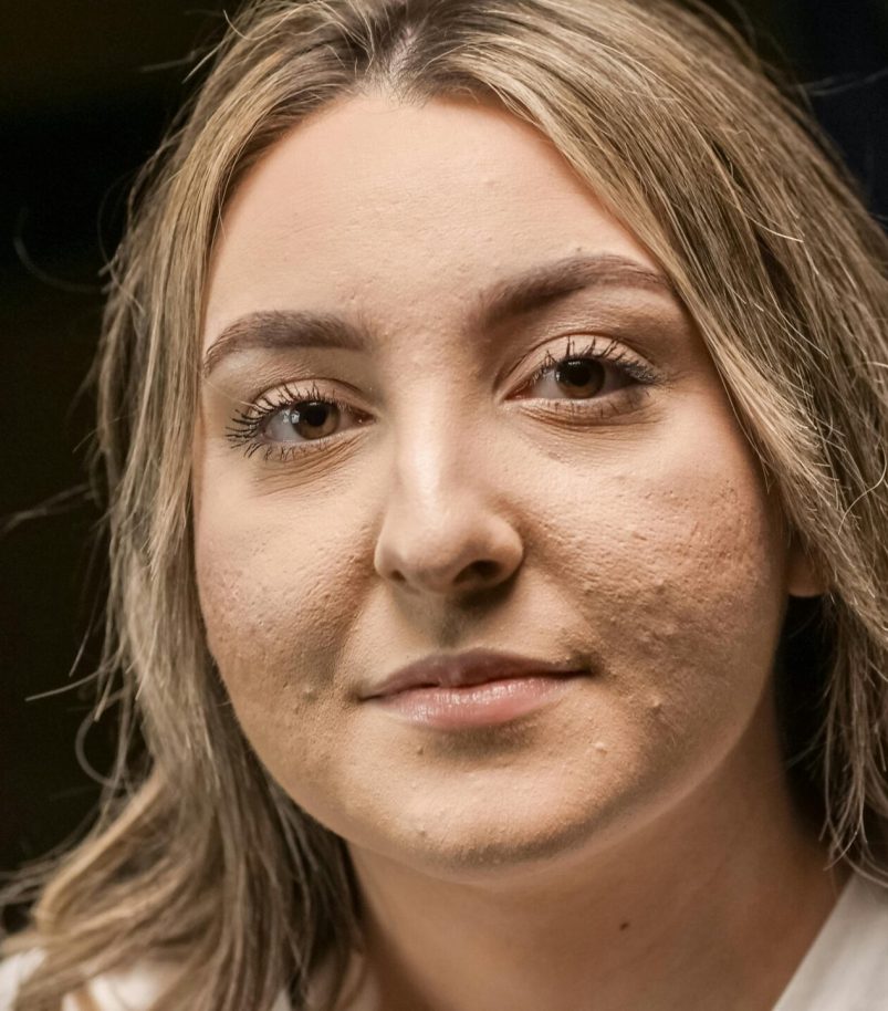 pexels-photo-7298680-7298680 A detailed close-up portrait of a woman showing natural skin texture and features.